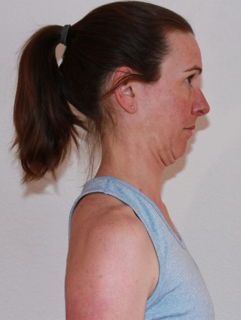 Person performing chin tuck exercise